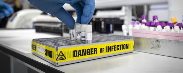 Pruebas de laboratorio para detectar coronavirus Pruebas de laboratorio para detectar coronavirus - Sputnik Mundo