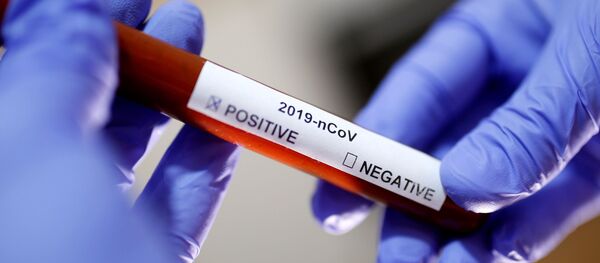 Prueba de sangre para identificar si una persona tiene coronavirus - Sputnik Mundo