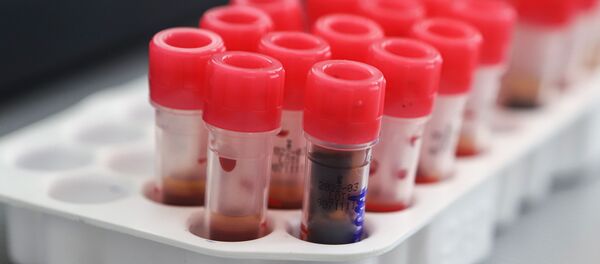 Donación de sangre - Sputnik Mundo