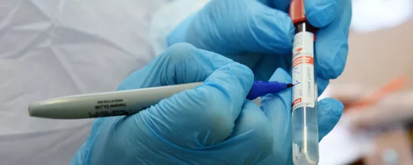 Una prueba para detectar el coronavirus Una prueba para detectar el coronavirus - Sputnik Mundo