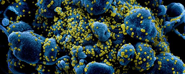 Una célula rodeada por el coronavirus SARS-CoV-2 - Sputnik Mundo