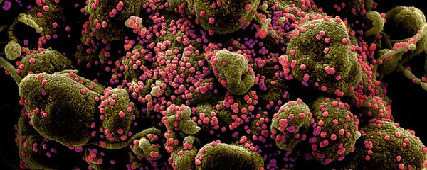 Micrografía electrónica coloreada de una célula humana (marrón verdoso) infectada por el virus SARS-COV-2 (rosa) - Sputnik Mundo