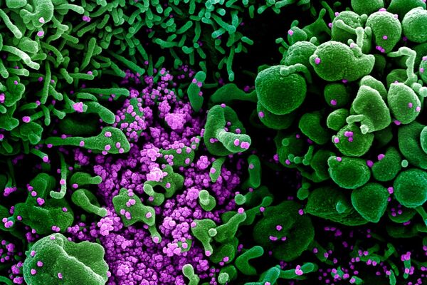 Micrografía electrónica coloreada de una célula humana (verde) infectada por el virus SARS-COV-2 (violeta) - Sputnik Mundo