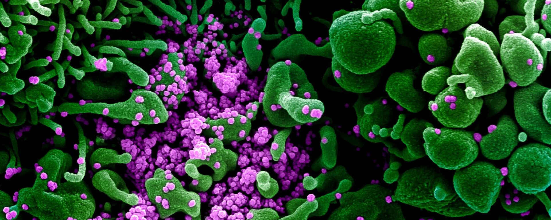 Micrografía electrónica coloreada de una célula humana (verde) infectada por el virus SARS-COV-2 (violeta) - Sputnik Mundo, 1920, 30.03.2021