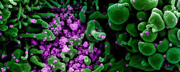 Micrografía electrónica coloreada de una célula humana (verde) infectada por el virus SARS-COV-2 (violeta) - Sputnik Mundo