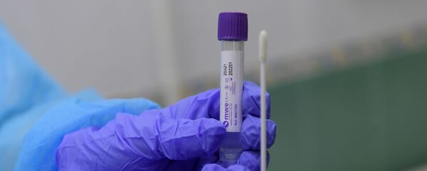 Un test para diagnosticar el coronavirus - Sputnik Mundo