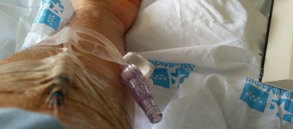 Vía en el brazo durante la estancia en el hospital. - Sputnik Mundo