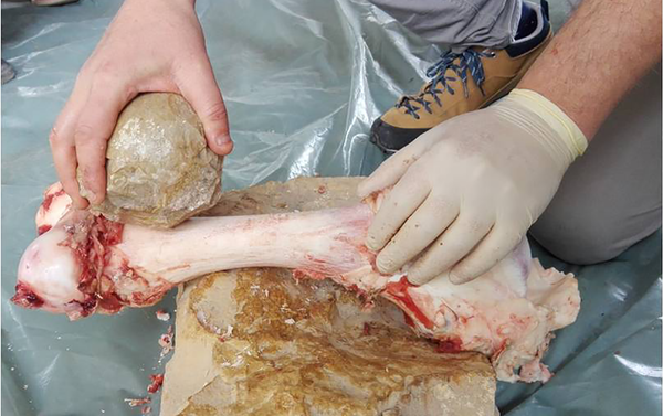 Experimento de extracción de médula ósea con bolas de piedra - Sputnik Mundo