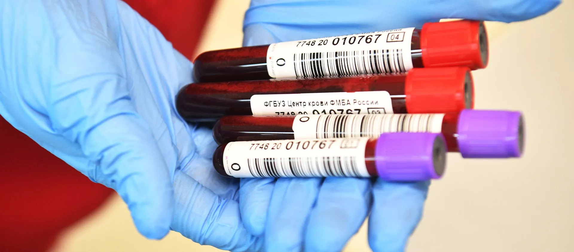 Plasma de la sangre de los donantes Plasma de la sangre de los donantes - Sputnik Mundo, 1920, 22.12.2021