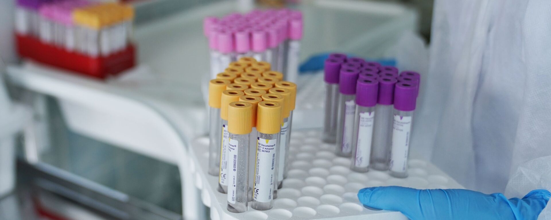 Laboratorio médico Laboratorio médico - Sputnik Mundo, 1920, 05.03.2021