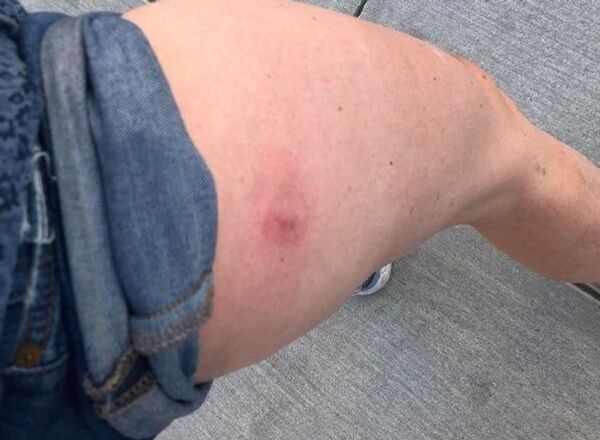 Nicole Roussell, periodista del Sputnik, herida por la policía mientras cubría una manifestación en Washington - Sputnik Mundo