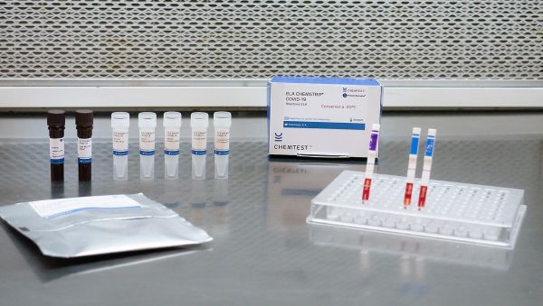 Test para diagnóstico de COVID-19 ELA-CHEMSTRIP Test para diagnóstico de COVID-19 ELA-CHEMSTRIP - Sputnik Mundo