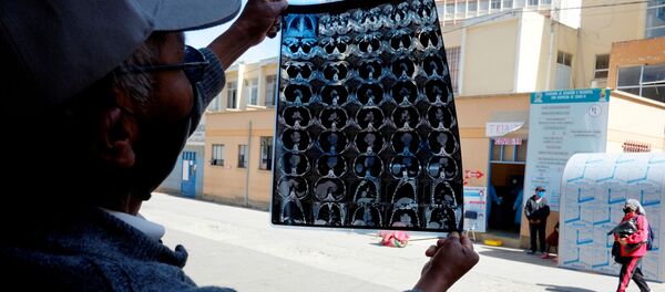 Un boliviano muestra la tomografía computarizada de los pulmones de su hijo - Sputnik Mundo