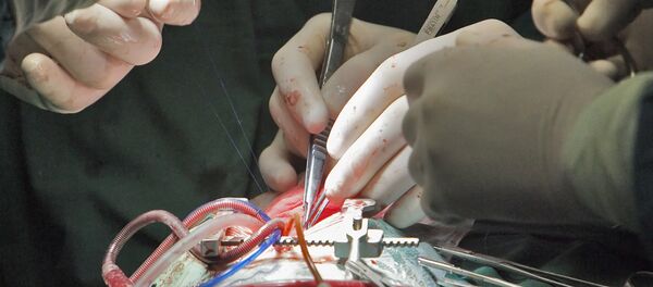 Cirugía del corazón - Sputnik Mundo