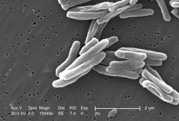 Mycobacterium tuberculosis es una bacteria responsable de la mayor cantidad de casos de tuberculosis en el mundo. Mycobacterium tuberculosis es una bacteria responsable de la mayor cantidad de casos de tuberculosis en el mundo. - Sputnik Mundo