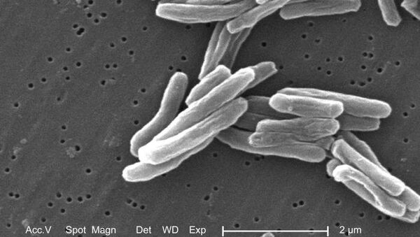 Tuberculosis mata cada año a 10.500 personas en Afganistán - Sputnik Mundo