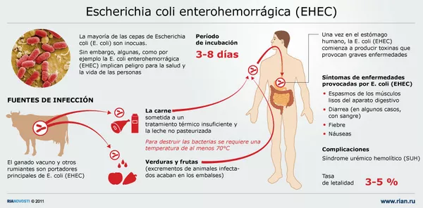 Escherichia coli enterohemorrágica (EHEC) - Sputnik Mundo