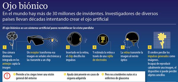 Ojo biónico - Sputnik Mundo