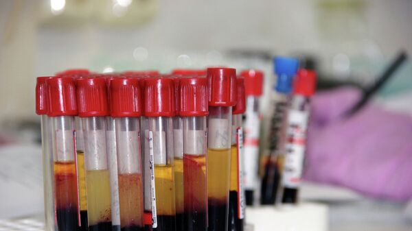 VIH en Rusia - Sputnik Mundo