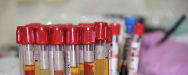 Un análisis de sangre servirá para detectar el Alzheimer - Sputnik Mundo