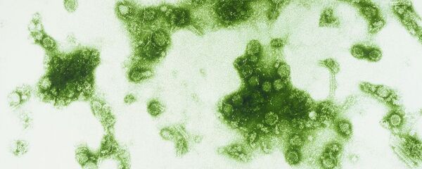 Вирус лихорадки Денге - Sputnik Mundo