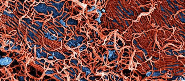 Rusia ensaya en primates sus vacunas contra el ébola - Sputnik Mundo